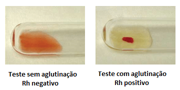 Testes de Rh